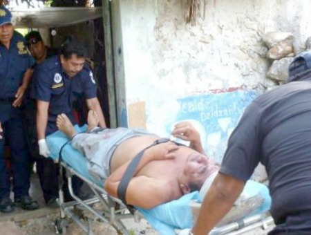 Por bajar huayas, abuelo de 81 años acaba fracturado