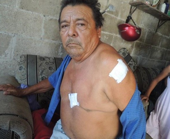 ‘La mano de Dios me salvó’, dice panadero atacado por violento pandillero