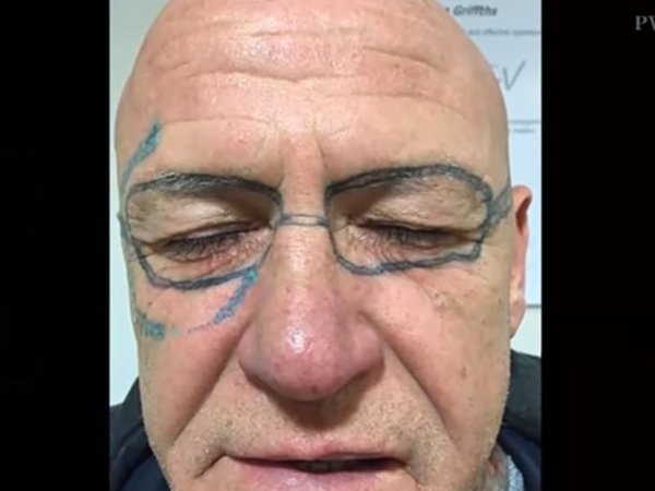 Se va de parranda y despierta con lentes tatuados