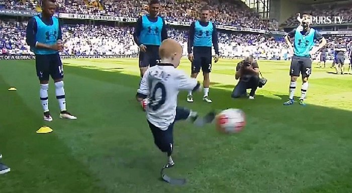 Sorprende jugando futbol niño con prótesis en las piernas