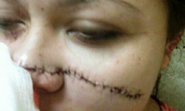 A prisión 10 meses sujeto que le cortó la cara a su mujer