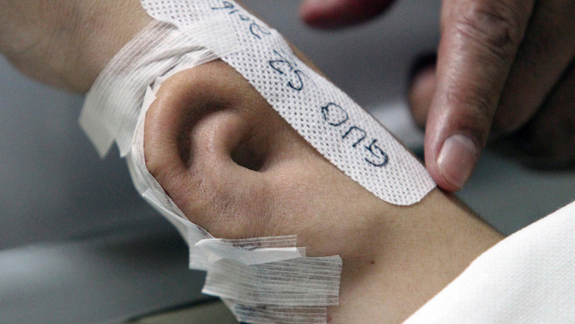 Le cultivan en el brazo la oreja que perdió en un accidente