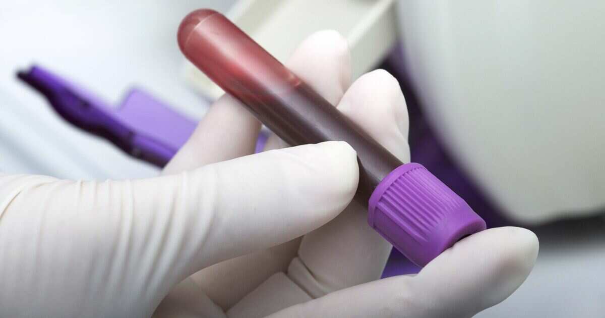 Una nueva prueba de sangre puede detectar más de 50 tipos de cáncer