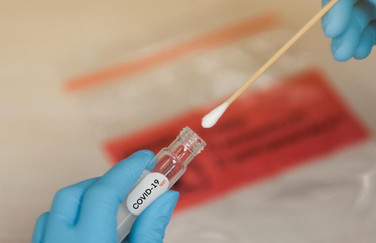 Hoy siete fallecidos y 1,037 contagios de Covid-19 en Yucatán