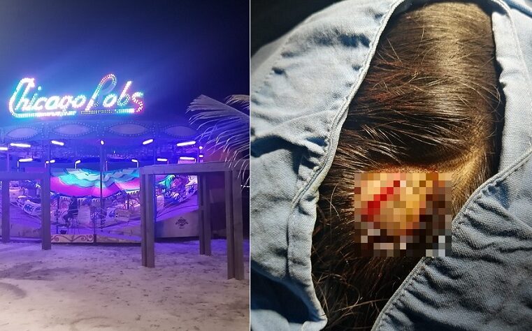 Otra de juegos mecánicos de Progreso: una menor se rompe la cabeza