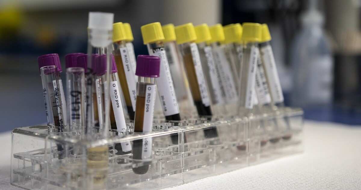 Japón autoriza venta de prueba sanguínea para detectar el Alzheimer