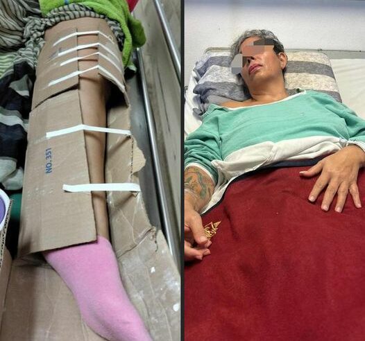 Con un cartón le inmovilizan la fractura a una paciente del IMSS en Yucatán