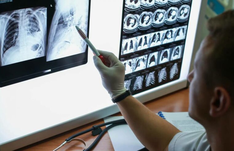 Los cinco tipos de cáncer que fueron más letales en el 2024