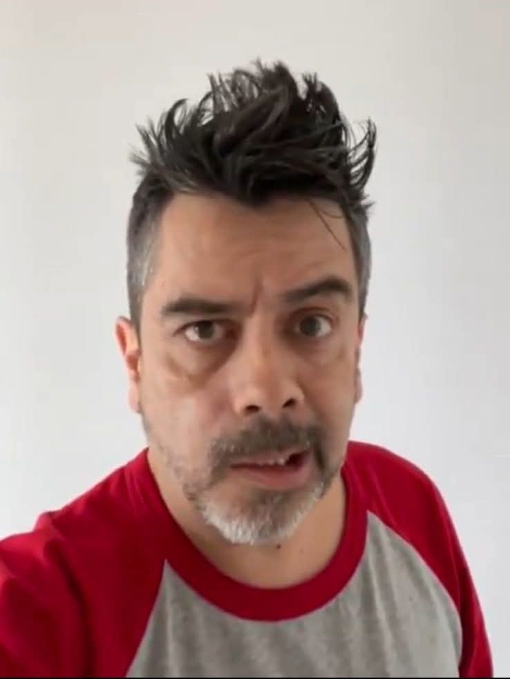 Carlos Espejel sufre parálisis facial por estrés