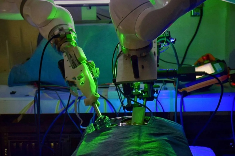 Un robot entrenado con IA opera una vesícula biliar sin ayuda humana