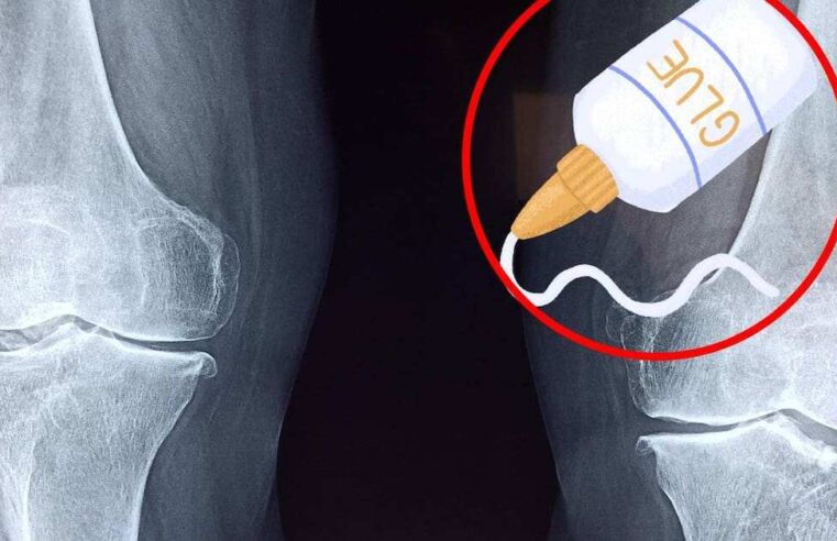 Científicos chinos crean un pegamento óseo para reparar fracturas en minutos