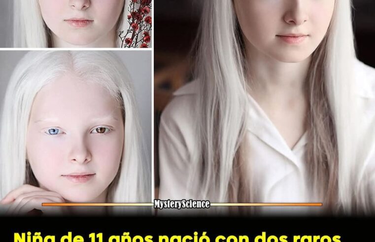 Niña excepcional: Es albina y tiene los ojos de distinto color