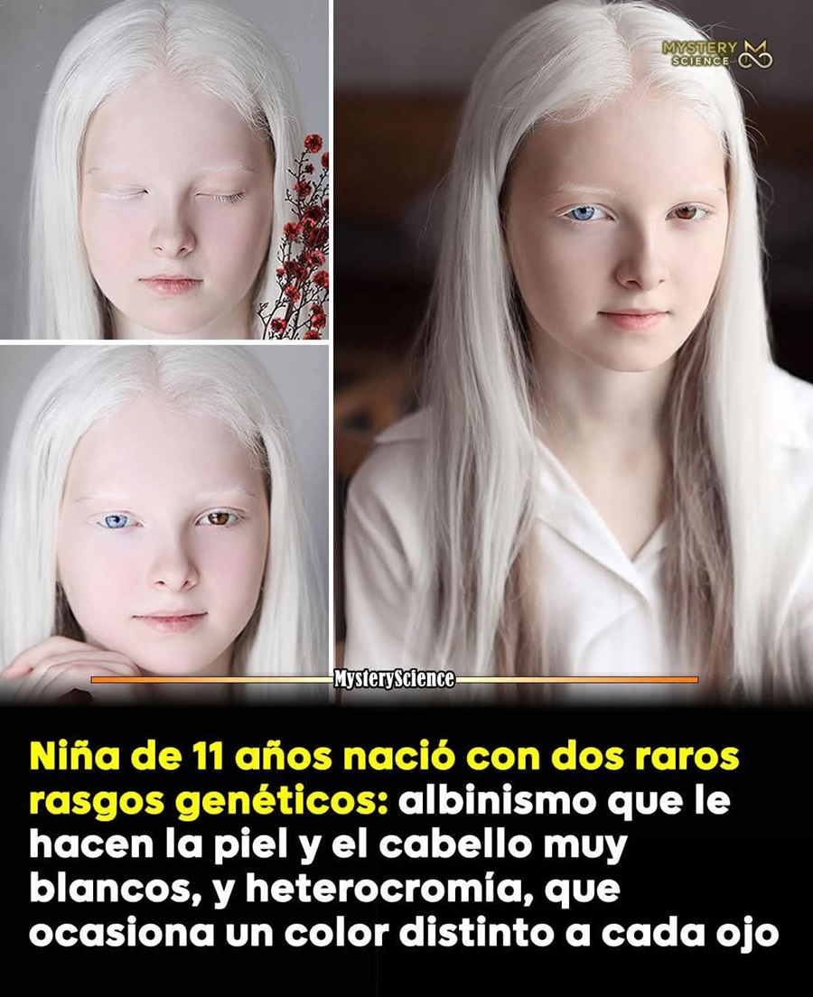 Niña excepcional: Es albina y tiene los ojos de distinto color