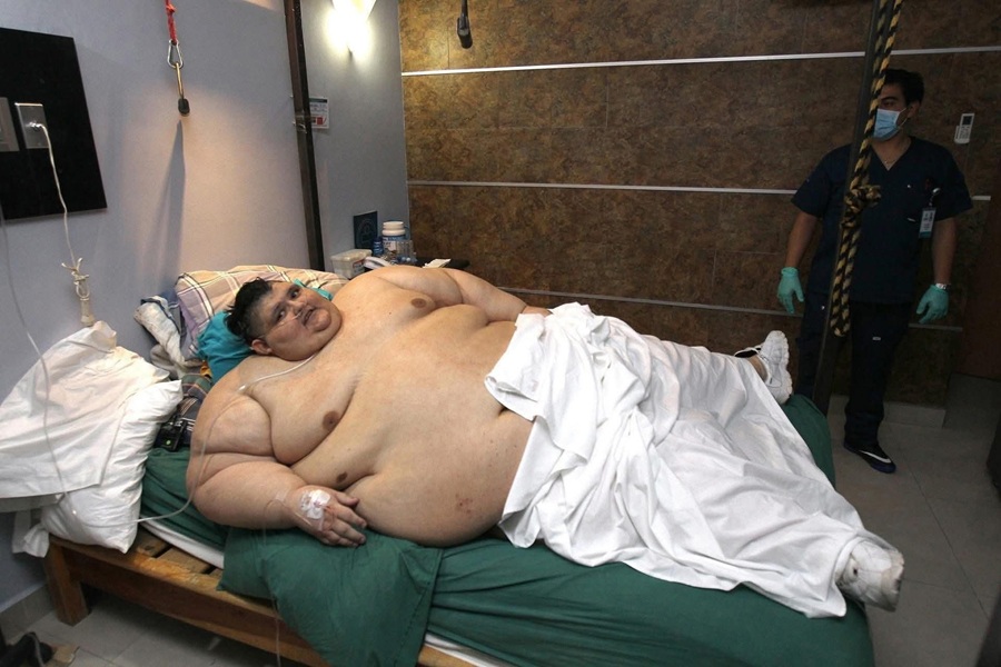 Muere el mexicano Juan Pedro Franco, el hombre más obeso del mundo