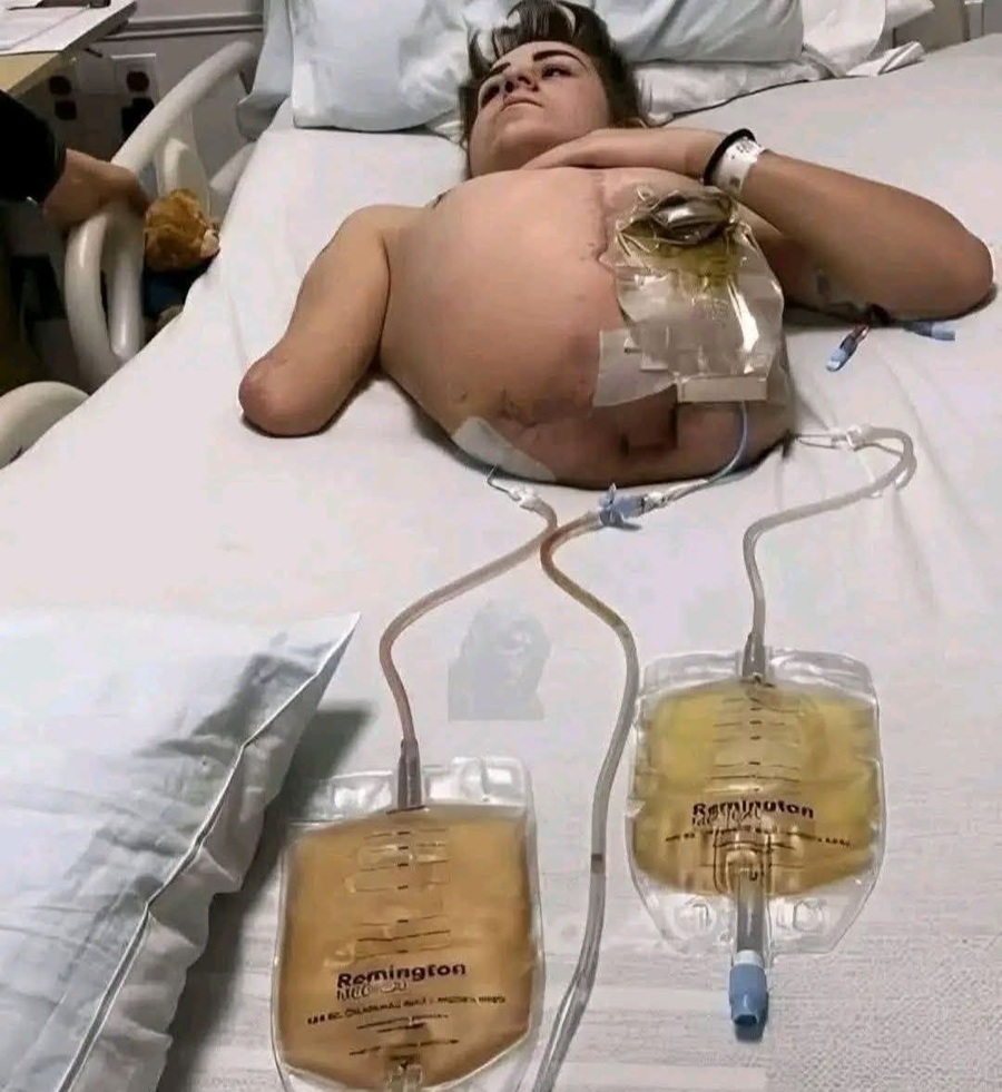 La máquina lo aplastó, los doctores lo cortaron en dos… jy sigue vivo!