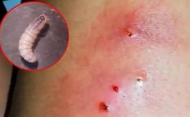 Confirman seis casos de gusano barrenador en personas