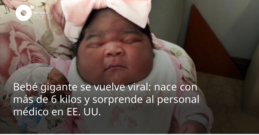 Bebé gigante nació con seis kilos de peso y parecía tener cinco meses