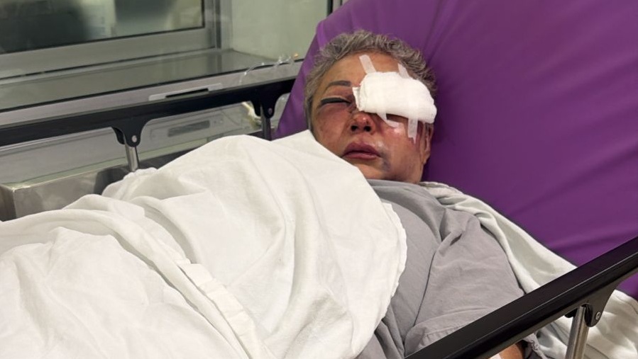 Agreden brutalmente a una mujer tras salir de un casino en el norte de Mérida