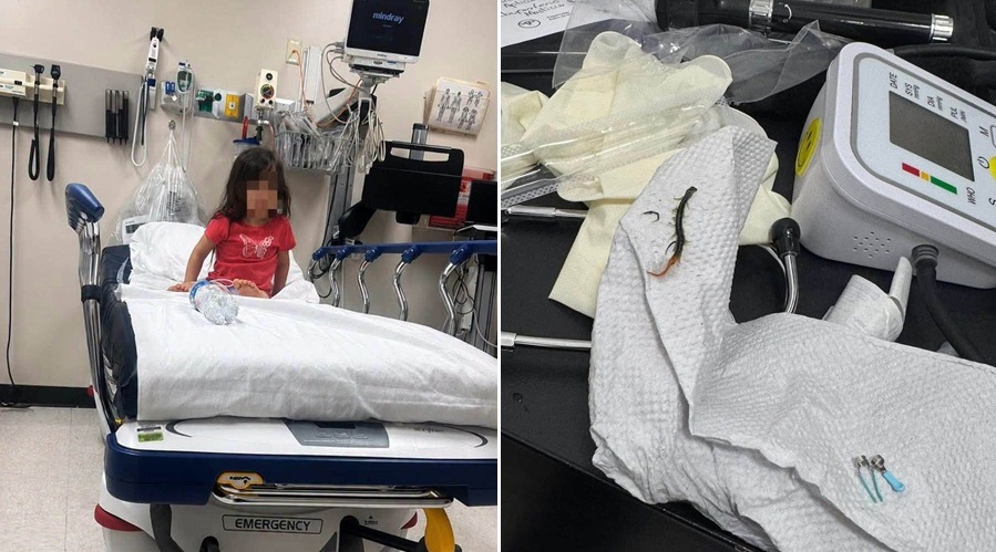 ¡Increíble! Niña sufría intenso dolor de oído y tenía ahí un ciempiés vivo