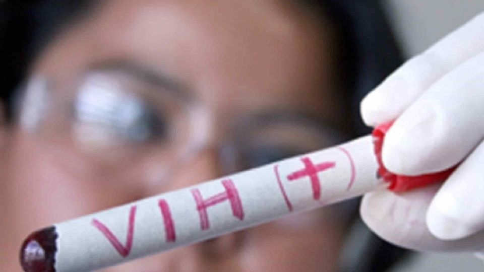 En México hay 128 mil personas con VIH sin diagnosticar